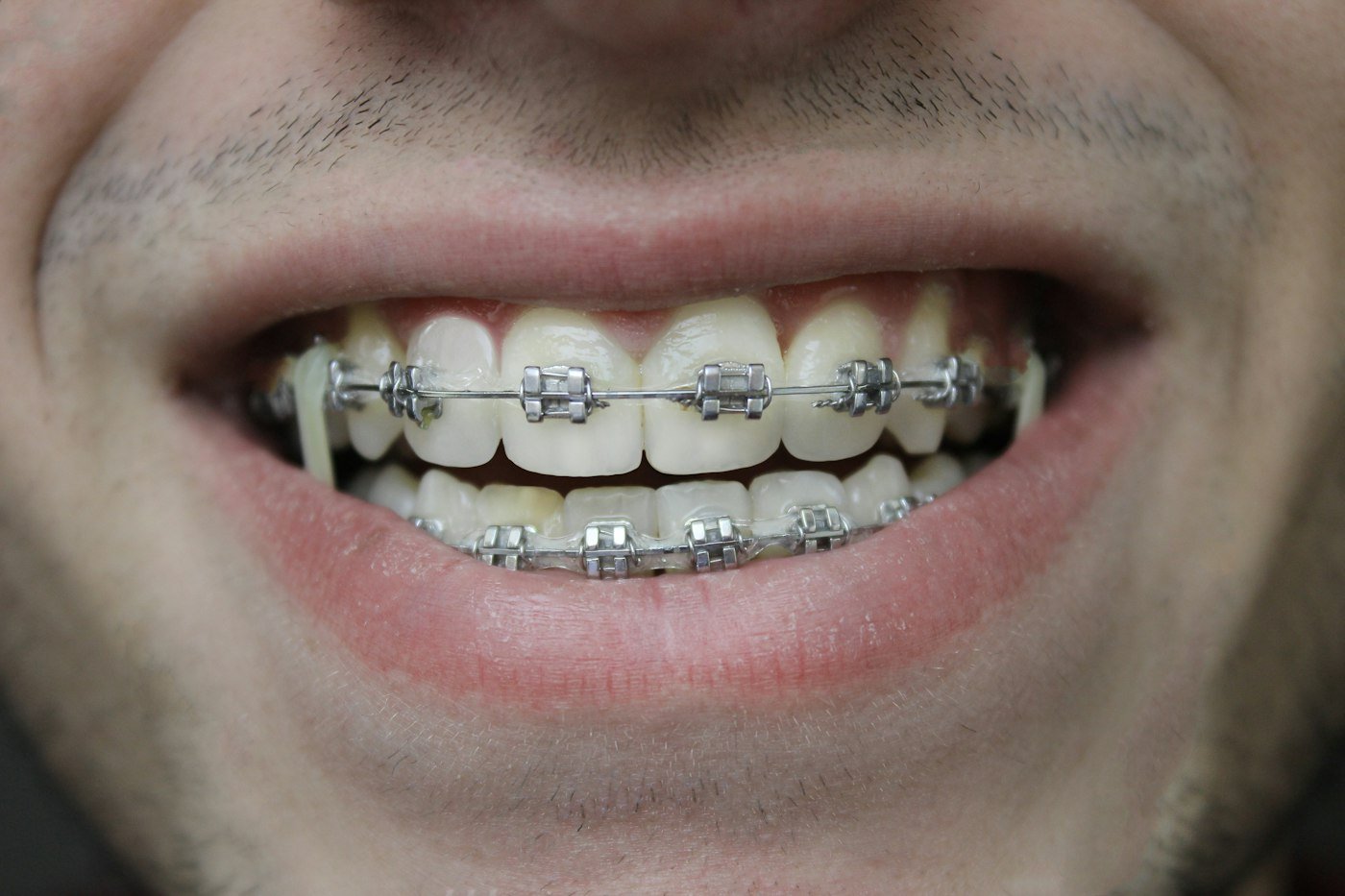 Close-up of a person's smile