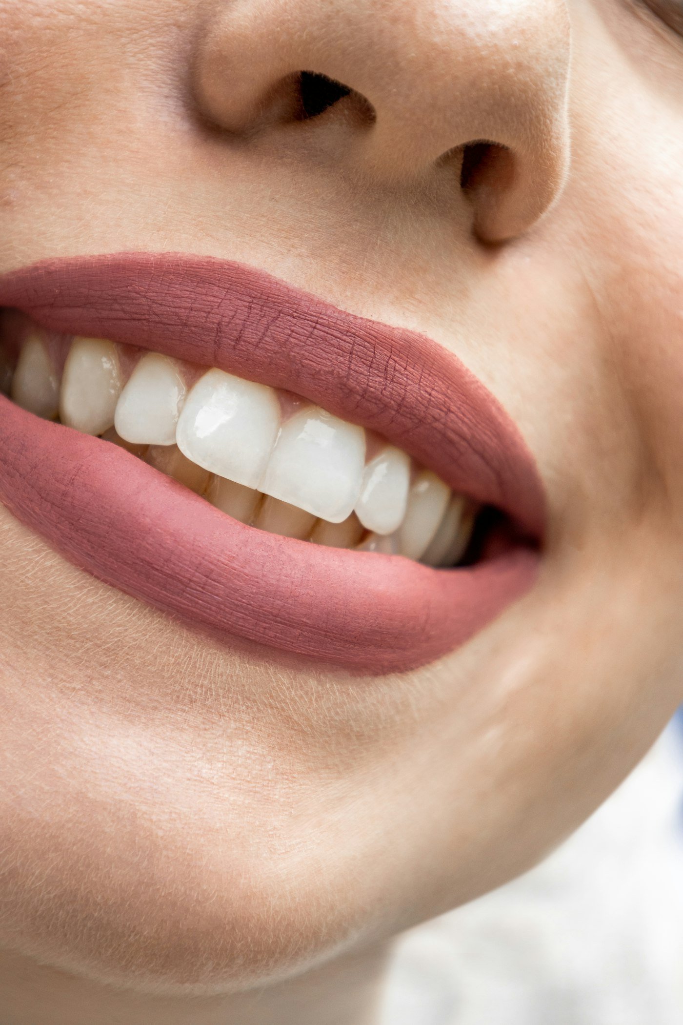 Close-up of a bright, well-aligned smile